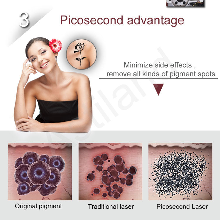 XSD-PL02 Picosecond Laser System Painless and Fast Remove all type pigments and tattoo