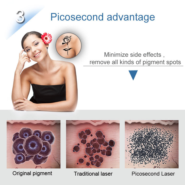 XSD-PL01 Picosecond laser beauty machine removal of tattoo