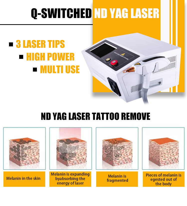 XSD-QL01 Q-SWITCHED ND YAG LASER BEAUTY MACHINE