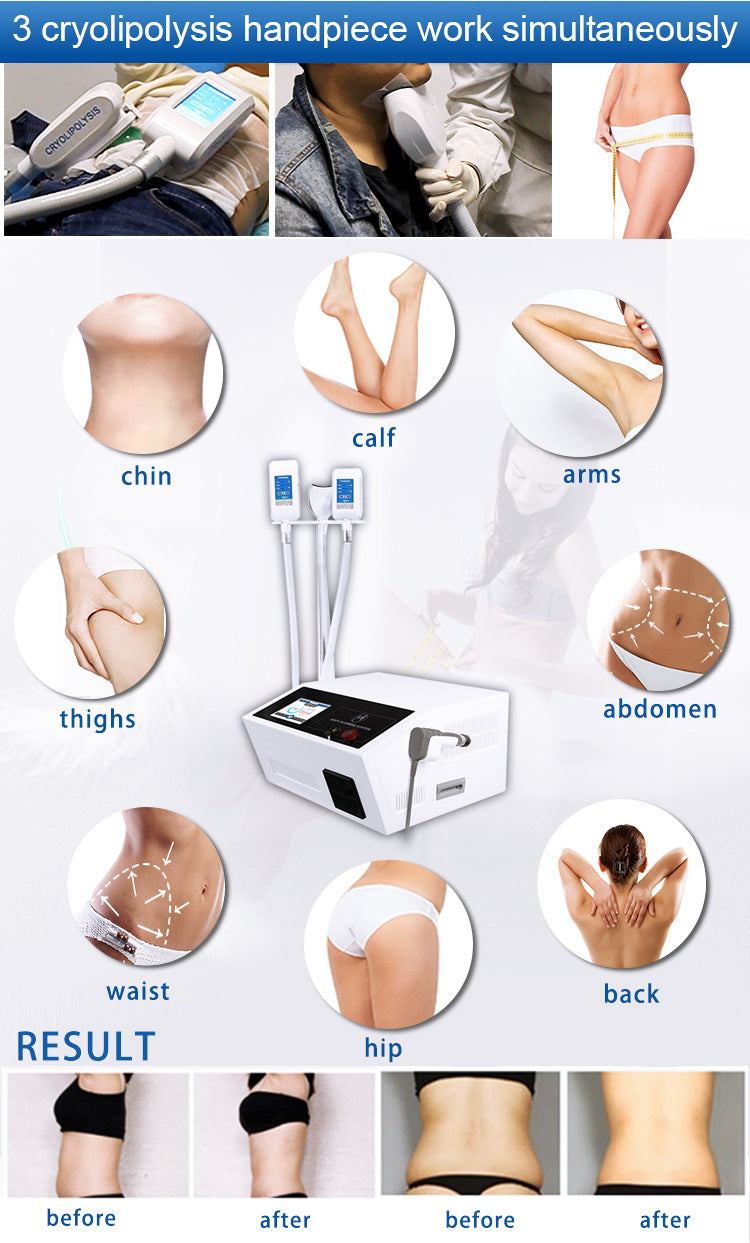 XSD-AS-CS1+ Cryolipolysis & Shockwave 2 in 1 System