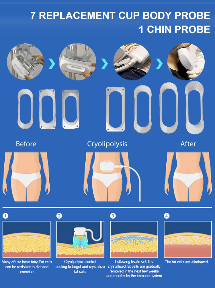 XSD-Cryomax01 Cryolipolysis 4 in 1 Slimming Machine