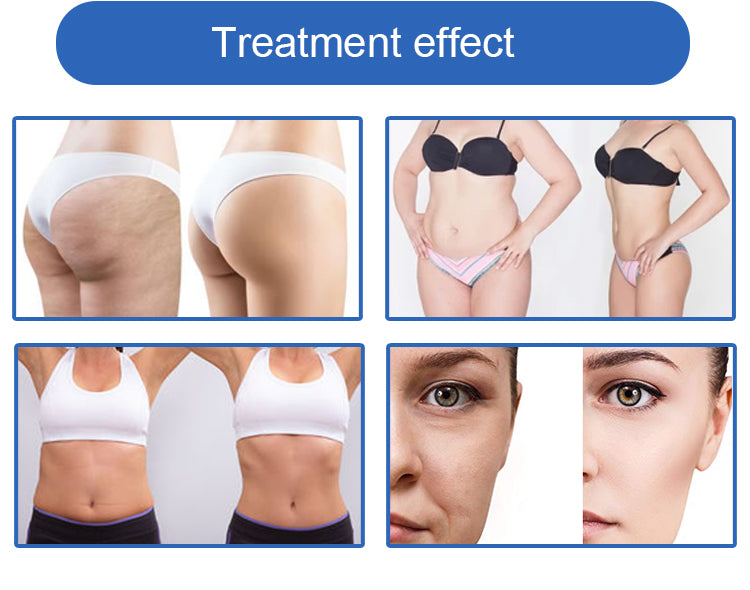 XSD-Cryomax01 Cryolipolysis 4 in 1 Slimming Machine